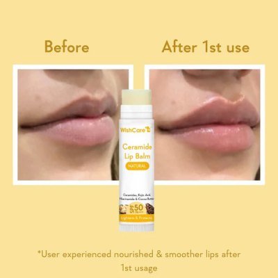 WishCare Ceramide Lip Balm with SPF 50 PA+++ (Natural) — view 4